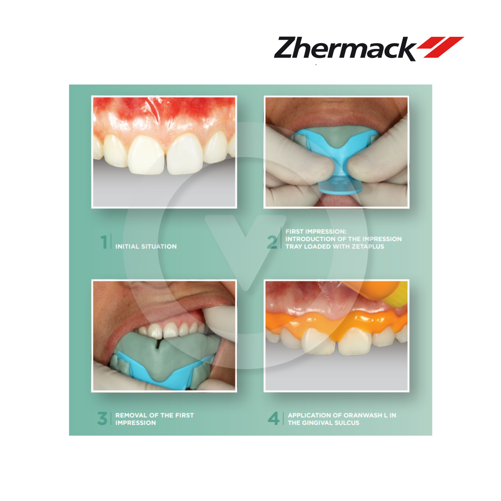 Zetaplus C-Silicone Kit