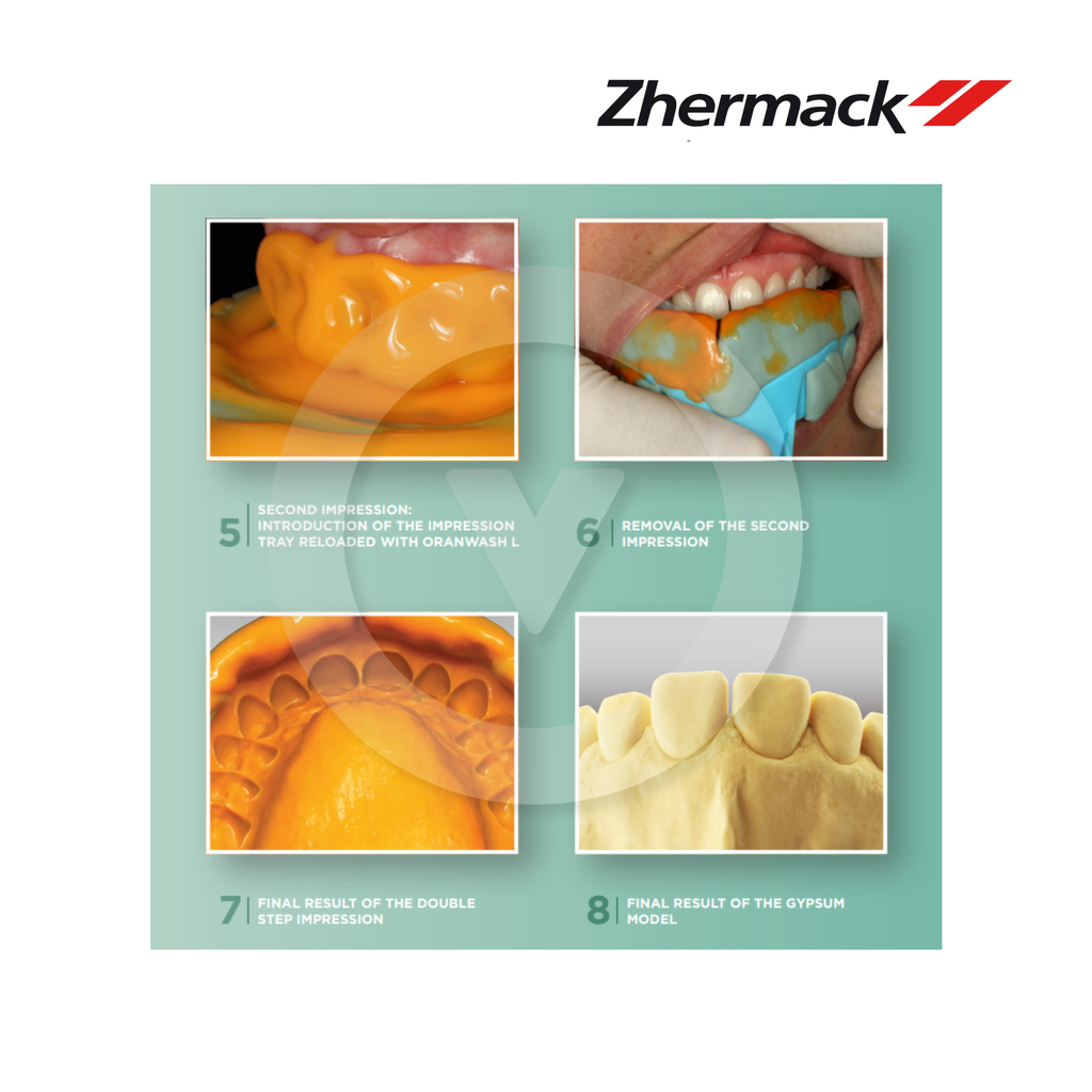Zetaplus C-Silicone Kit