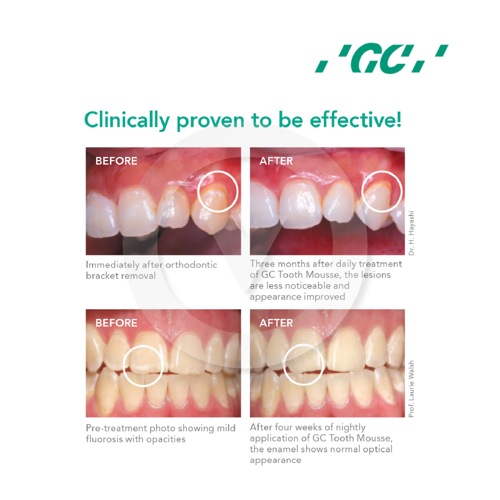 GC Tooth Mousse Plus