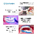 Gingiva Shield (2).webp