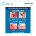 Gengigel 20ml Tube